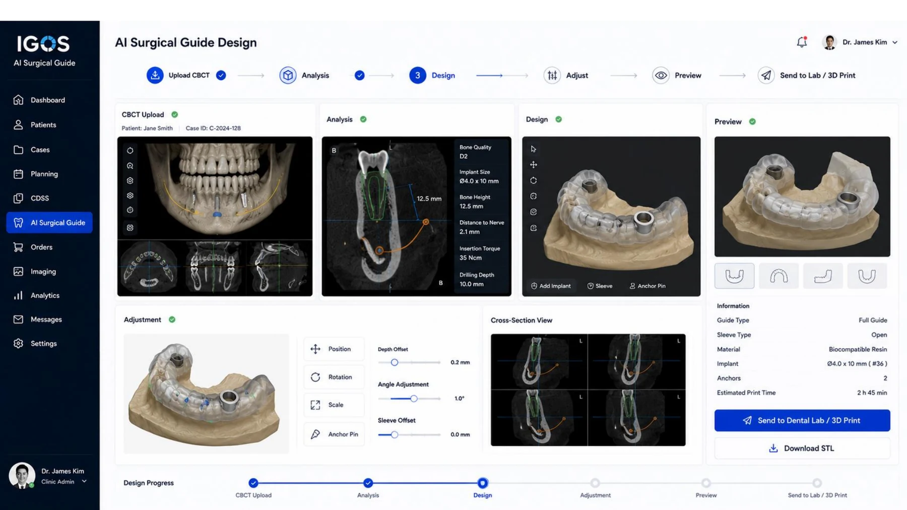 AI surgical guide design UI