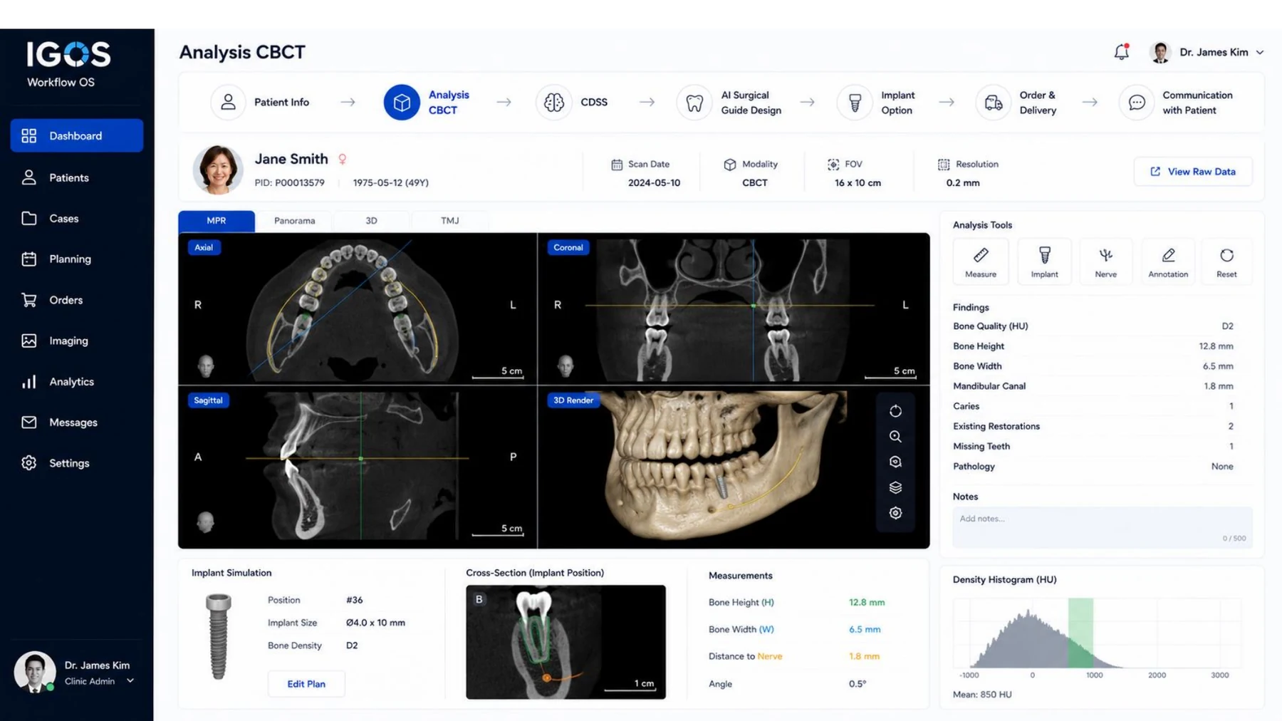 Analysis CBCT UI
